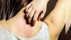 लिंग की खुजली के लिए उपचार लिंग की खुजली के लिए उपचार
