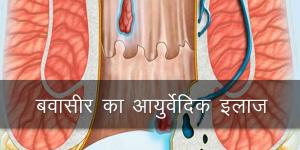 फिस्टुला या भगंदर, पाइल्स या बवासीर, किशमिश से बवासीर का इलाज, एलोवेरा से बवासीर का इलाज, हल्दी से बवासीर का इलाज इन हिंदी, केला से बवासीर का इलाज, पुरानी बवासीर का इलाज, फिटकरी से बवासीर का इलाज, बवासीर का होम्योपैथिक इलाज, बवासीर का अंग्रेजी दवा